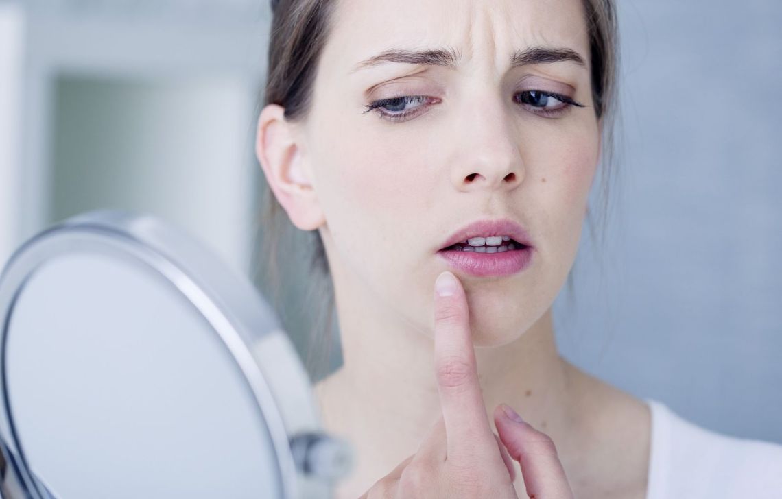 L'herpès labial : comprendre et traiter avec les produits pharmaceutiques